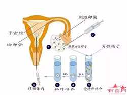 上海代生子包成功，国际试管婴儿移植成功后注意事项科普
