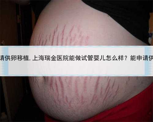 试管如何申请供卵移植,上海瑞金医院能做试管婴儿怎么样？能申请供卵试管吗